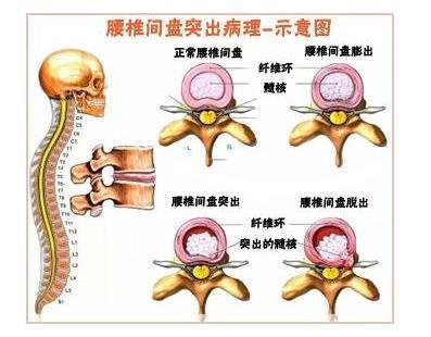 三个月能练出肌肉吗？探究短期健身的可行性与挑战